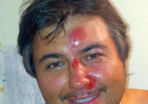 Максим Максимов чудом остался в живых